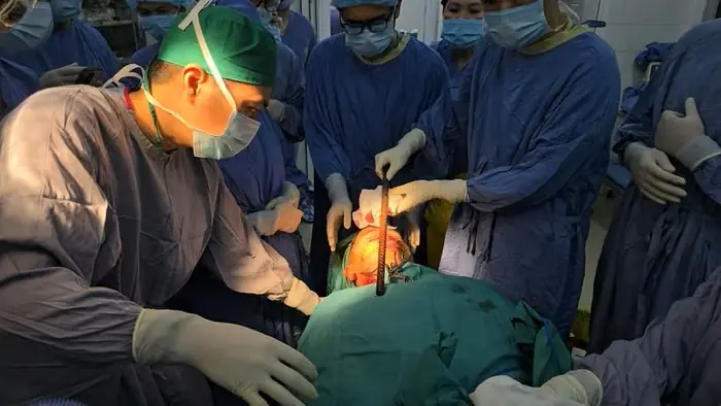 Giành lại sự sống cho bệnh nhân bị thanh sắt xuyên mặt